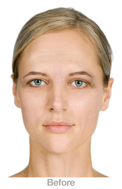 DroopyBrow