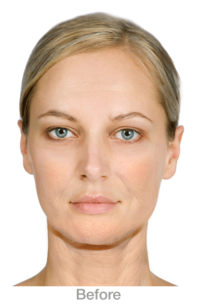 FaceNecklaxity